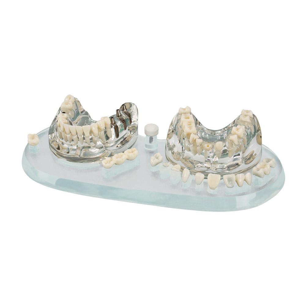 Studiemodel Demo Implantaat C+B, stuk
