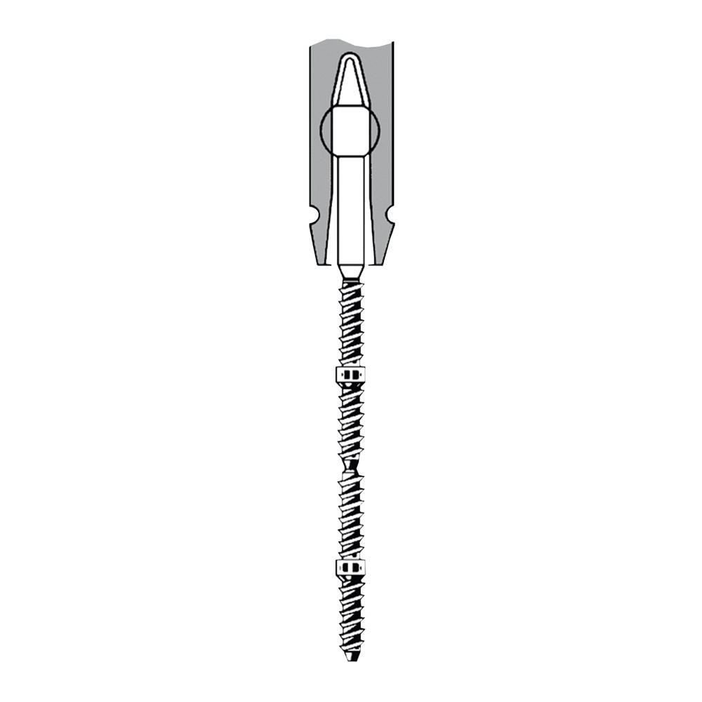TMS Link plus stiften Minim titanium 0,525 mm zilver, 60 stuks