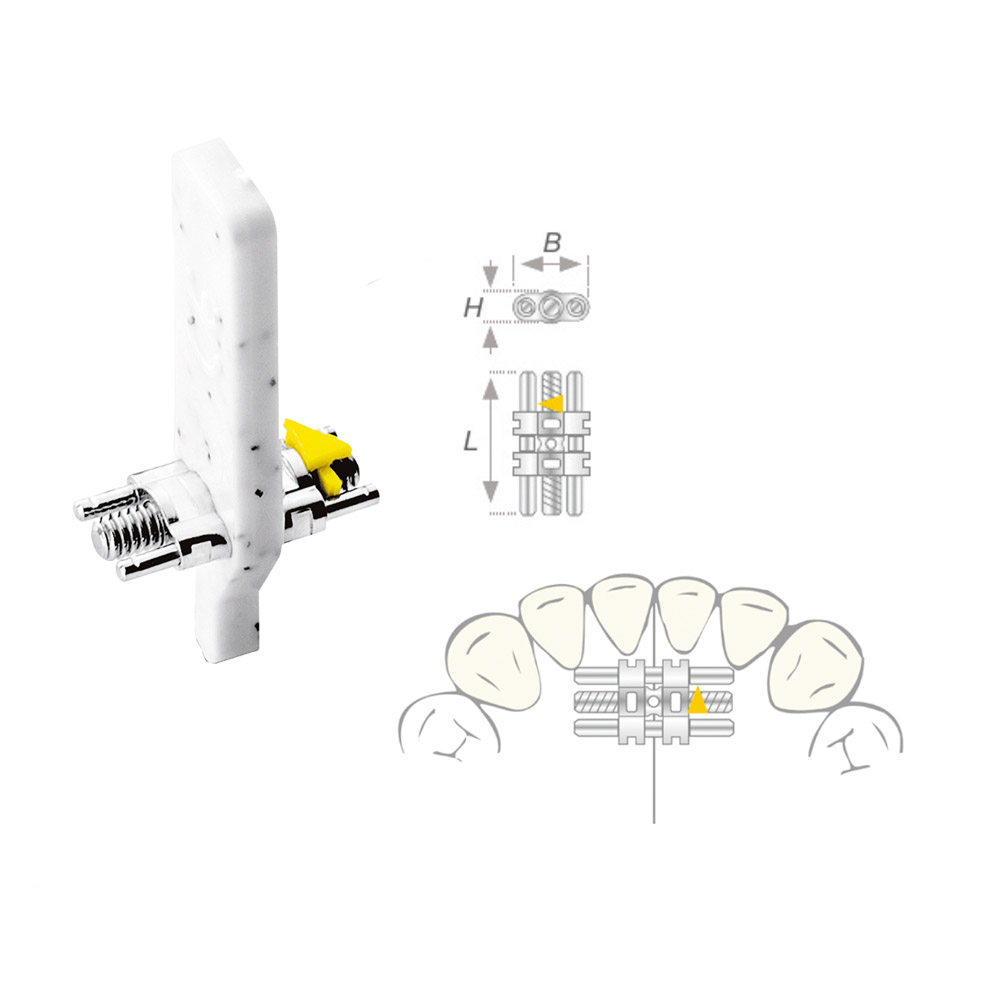 Vector 50 trekbout Micro, 50 stuks