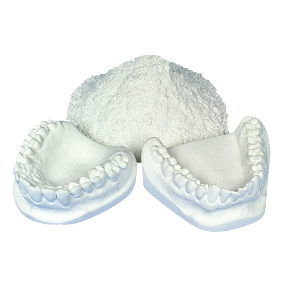 Alabastergips NPU, 10 kg emmer