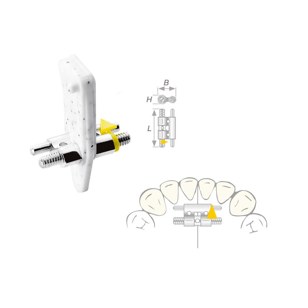 Uittrekschroef Vector 080 medium, 10 stuks