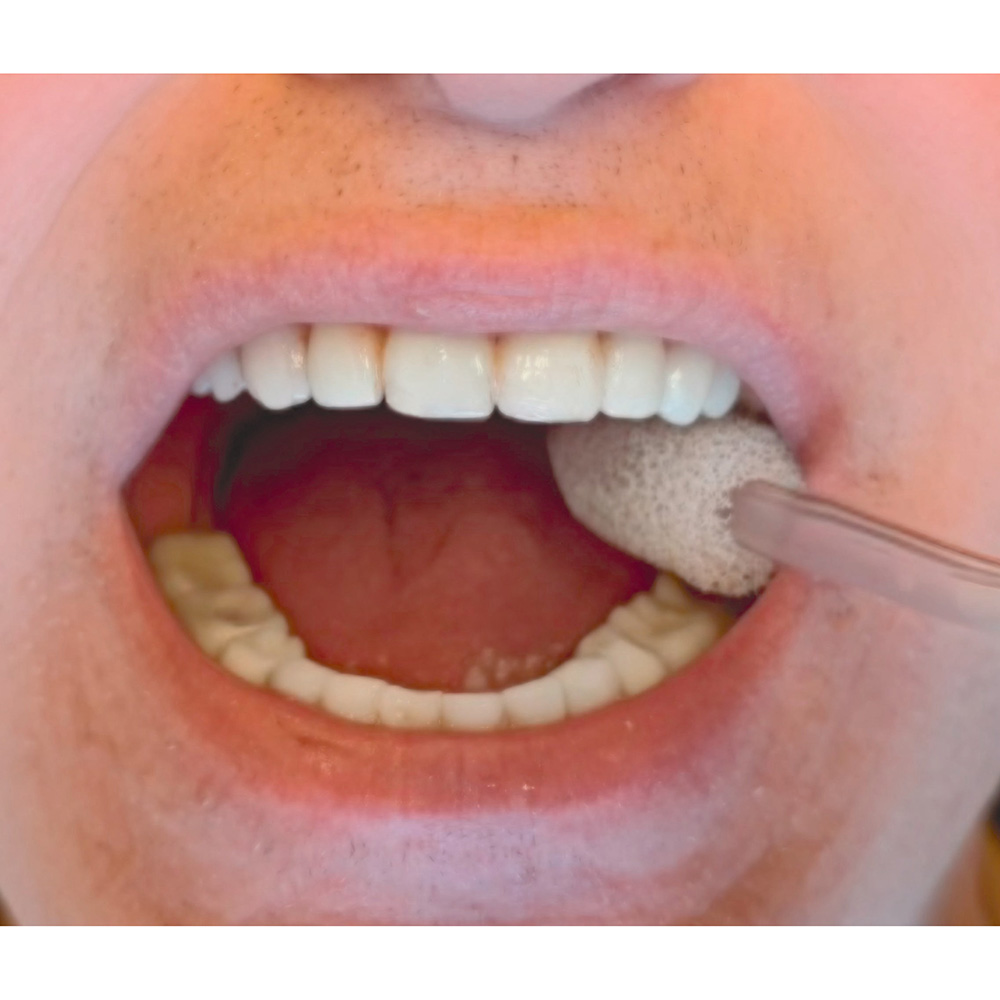 Comfi-Tips zuigkussentjes voor speekselsaugers, 100 stuks