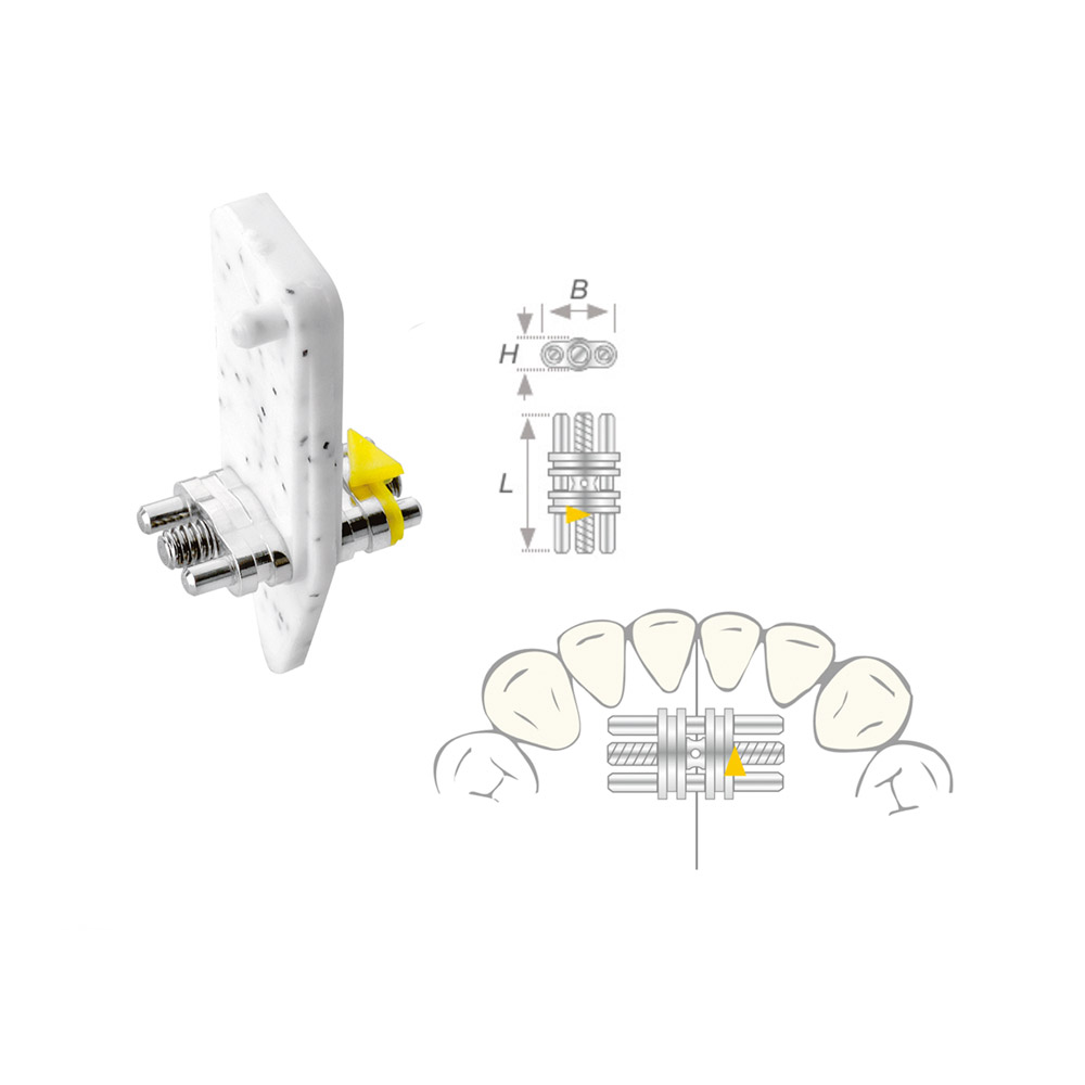 Rek-schroef Vector 100 mini, 50 stuks